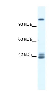 GRIN2C / NMDAR2C / NR2C Antibody (aa69-118, Biotin)