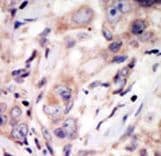 ROR2 Antibody (aa915-943)
