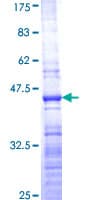 Human RPL36 / Ribosomal Protein L36 (Recombinant GST)