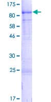 Human RAF1 / RAF Protein (Recombinant GST)