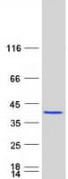 Human PDCL3 Protein (Recombinant Myc-DDK (Flag))