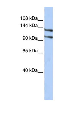 Polyclonal Rabbit anti-Human RBM5 / G15 Antibody (N-Terminus, IHC, WB)
