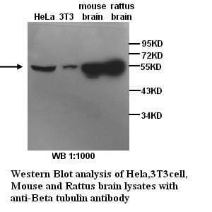 TUBB / Beta Tubulin Antibody