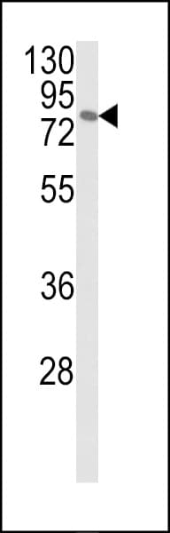 IHC-plus™ Polyclonal Rabbit anti-Human MAPK8IP1 / JIP1 Antibody (aa470-498, IHC, IF, WB)