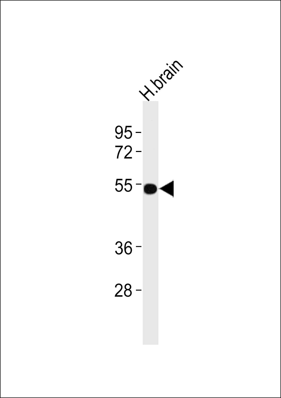 CCKBR / Cckb Antibody