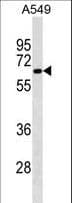 Monoclonal Mouse anti-Human PODXL / Podocalyxin Antibody (aa410-439, IF, WB)