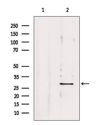 OTUB2 Antibody