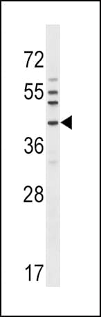 NKX6-1 Antibody (aa285-314)
