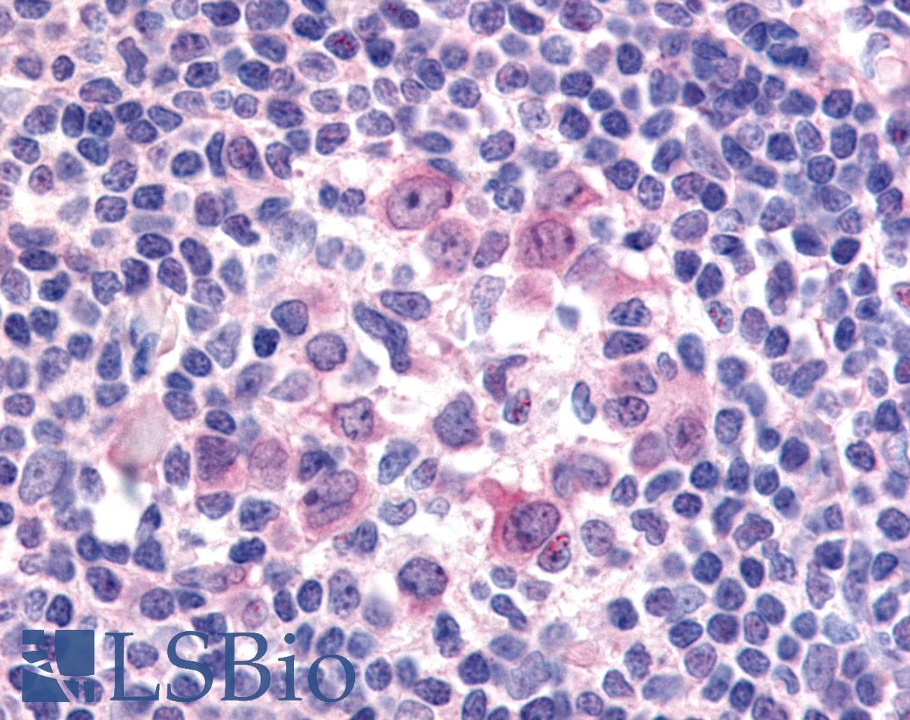 IHC-plus™ CD135 / FLT3 Antibody