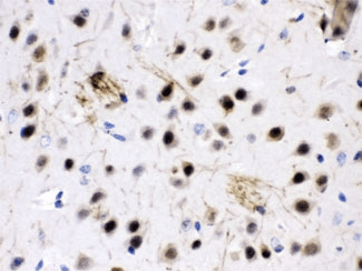 ZWINT Antibody