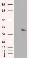 IHC-plus™ MCL1 / MCL 1 Antibody (clone 10C5)
