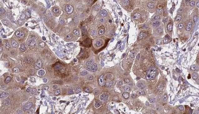 GYPC / Glycophorin C Antibody