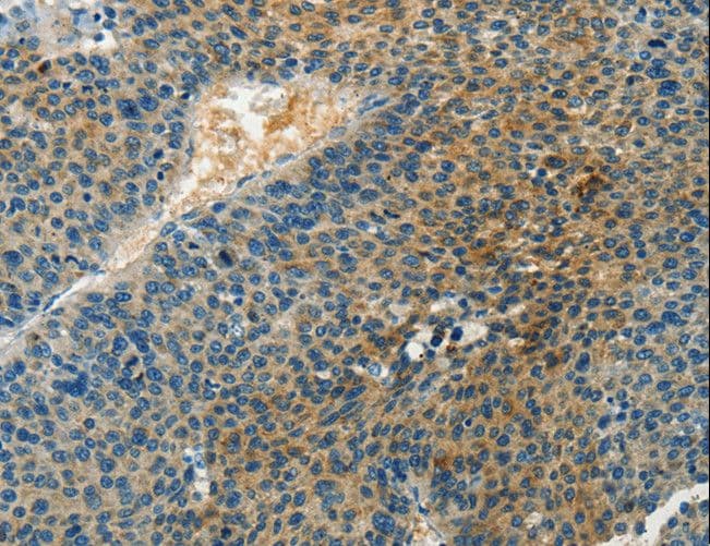 DGKB / DGK Beta Antibody