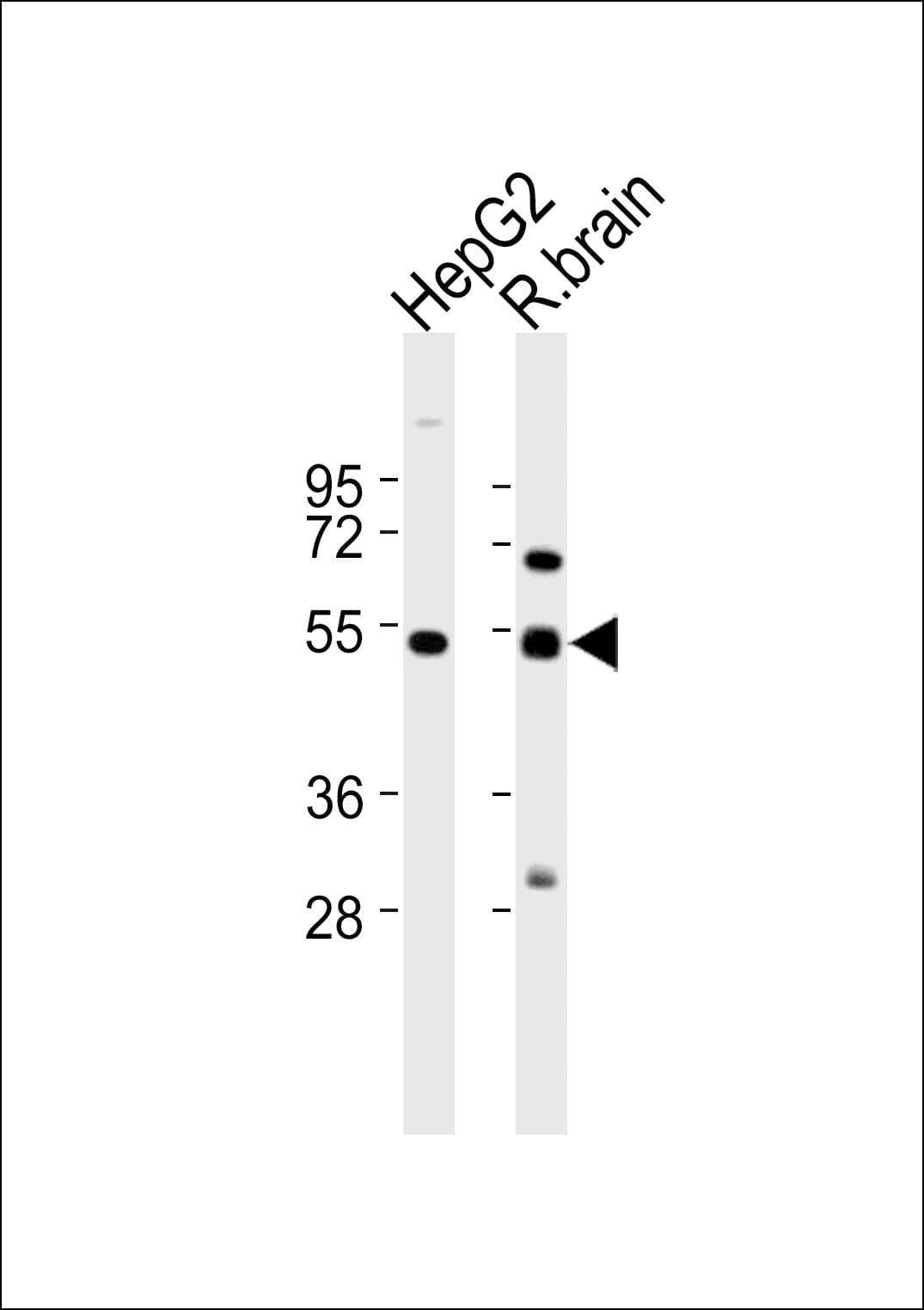 Polyclonal Rabbit anti-Human CAMKV Antibody (WB)