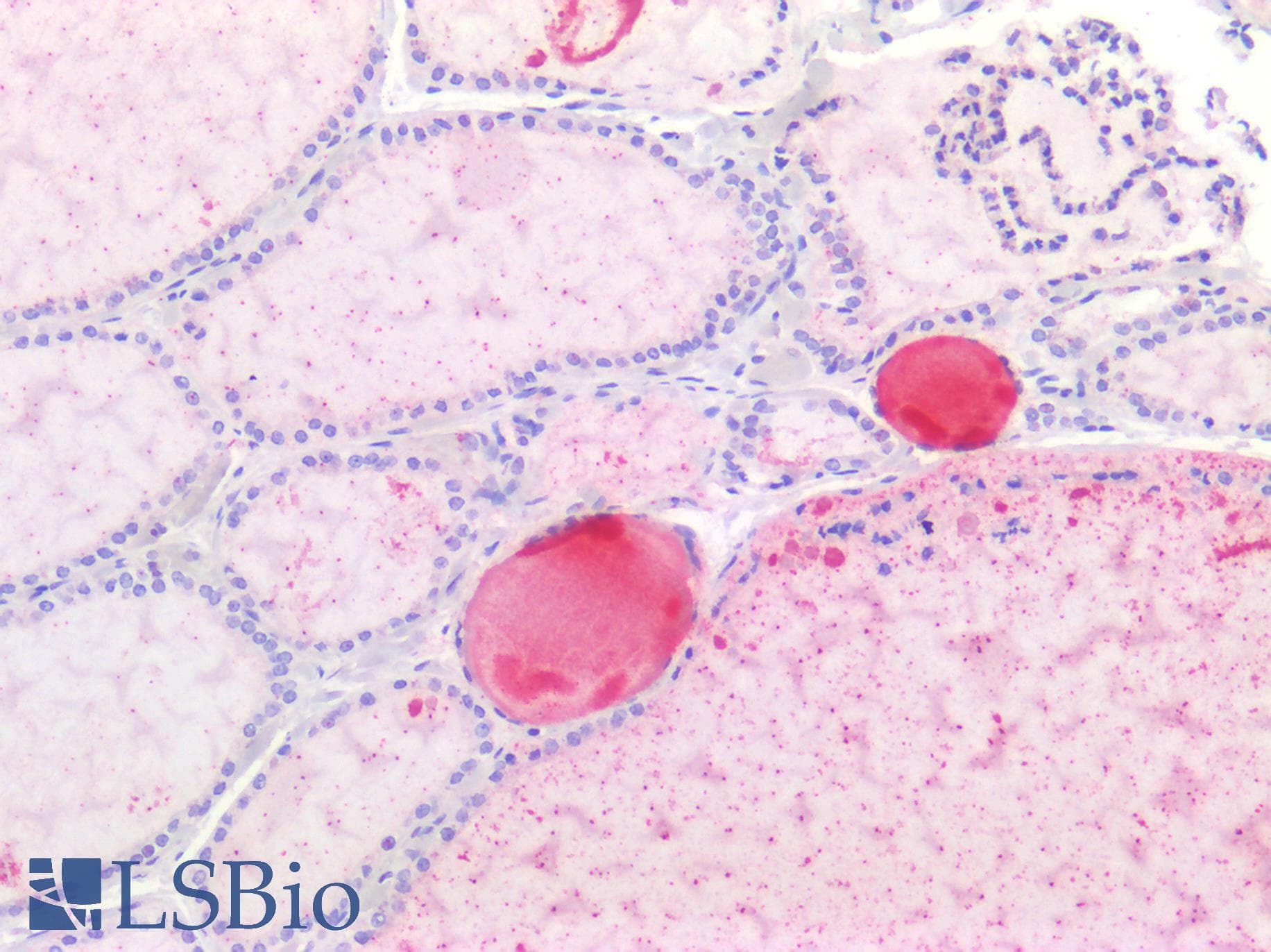 PathPlus™ Polyclonal Rabbit anti-Human NKX6-1 Antibody (IHC)