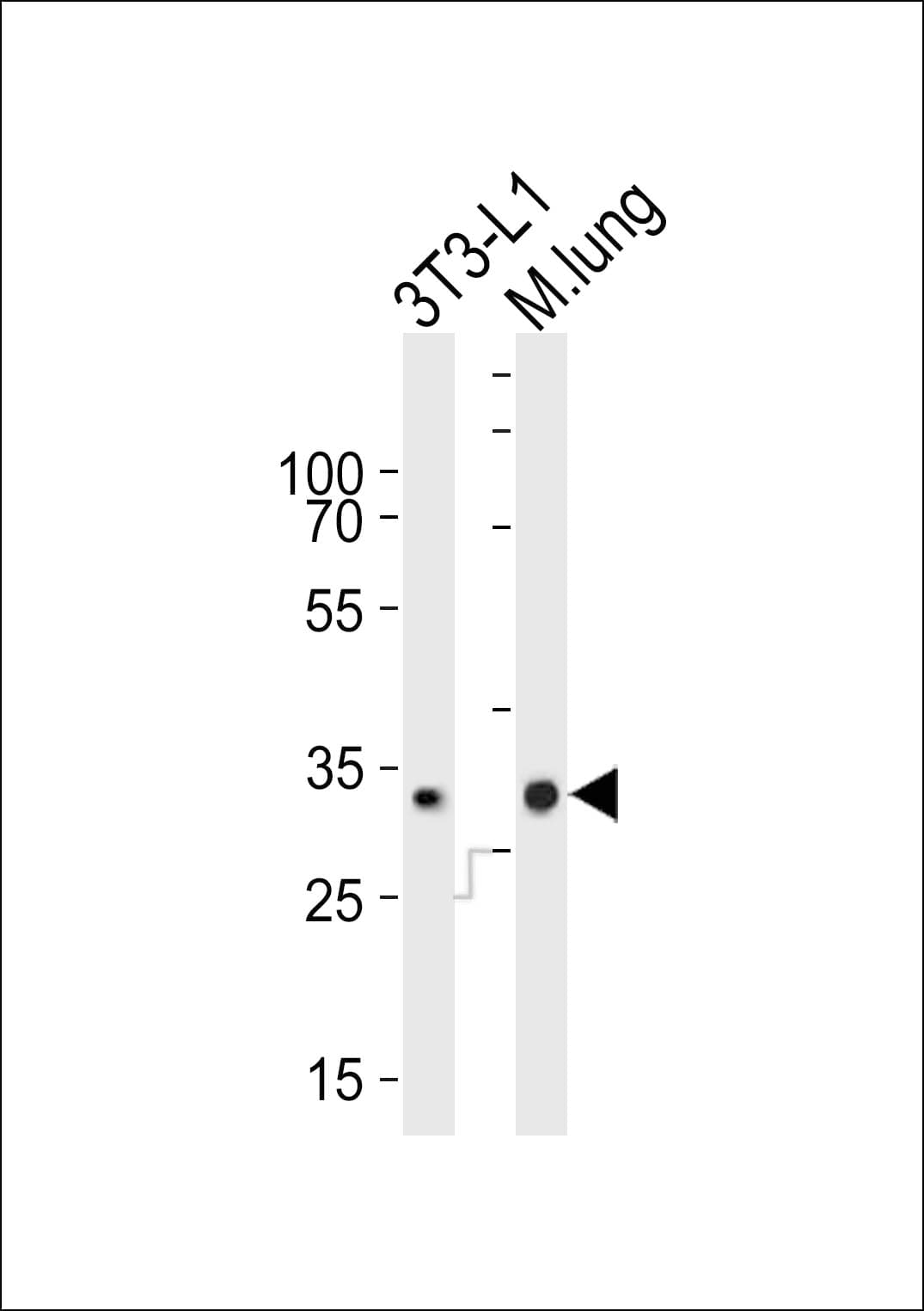 NEDF / VPS24 Antibody (aa28-61)