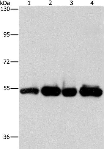 Polyclonal Rabbit anti-Human PDE4D Antibody (IHC, WB)