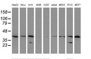 UBE2J1 Antibody (clone OTI1F6)