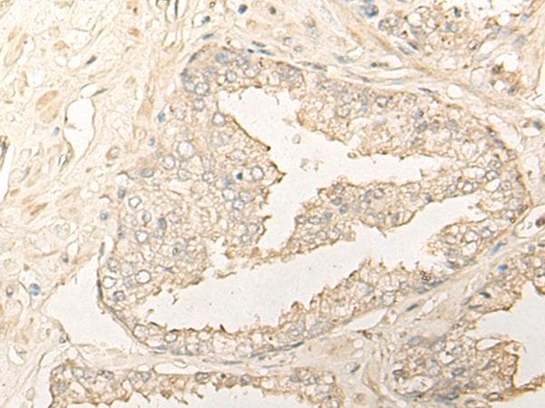 DIMT1L Antibody