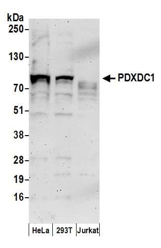 Polyclonal Rabbit anti-Human PDXDC1 Antibody (aa550-600, WB)
