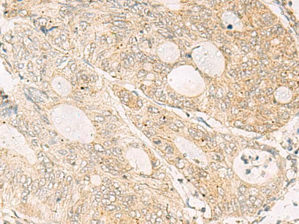 NQO2 Antibody
