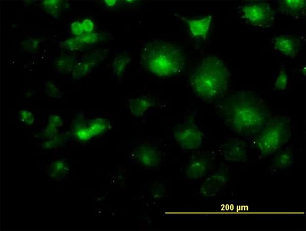 Monoclonal Mouse anti-Human LFNG / Lunatic Fringe Antibody (clone 2D10-3C11, IF, WB)