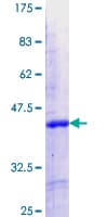 Human IKZF5 Protein (Recombinant GST, N-terminus)