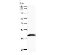 Monoclonal Mouse anti-Human CARD8 / Cardinal / TUCAN Antibody (clone 2108C2a, IF, WB)