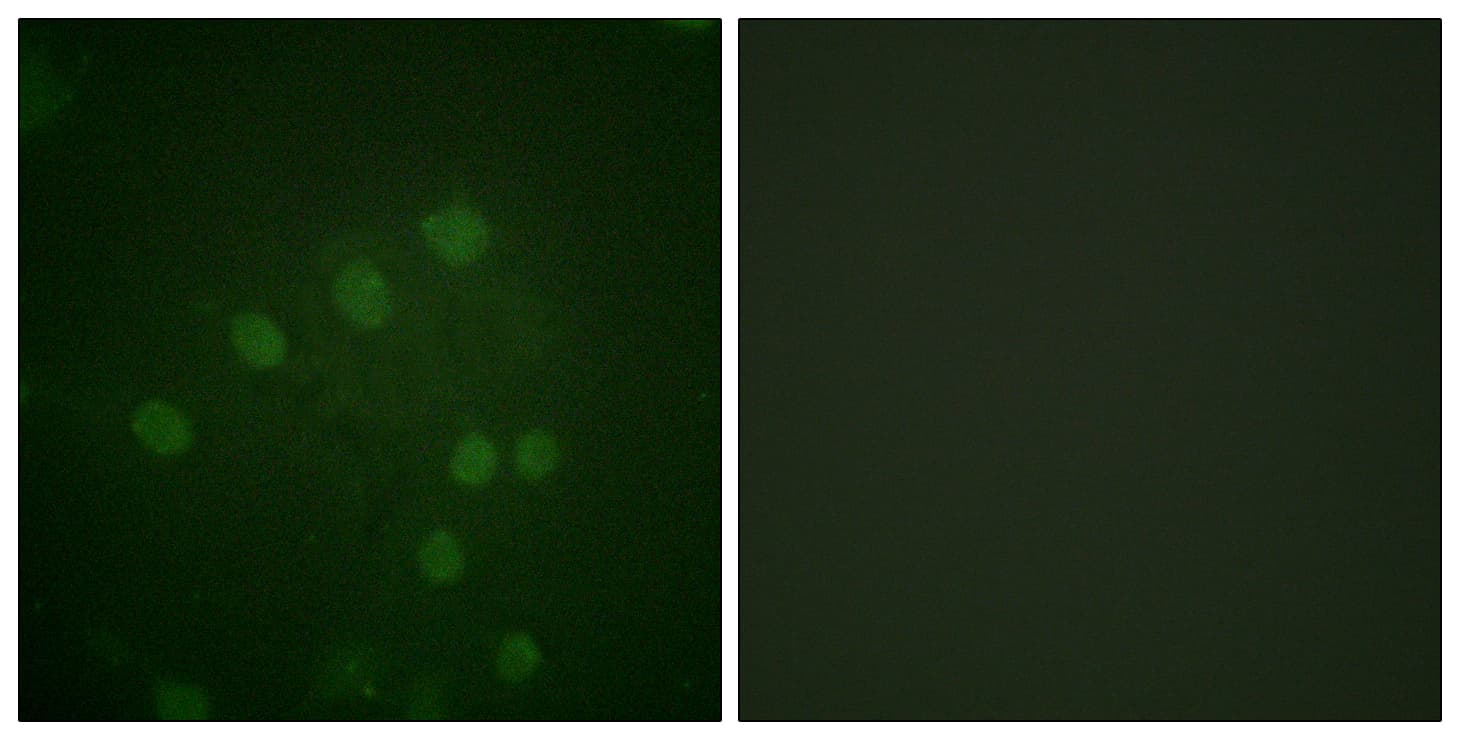 AURKB / Aurora-B Antibody (phospho-Thr232)