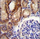 CLC-7 / CLCN7 Antibody (aa692-720)