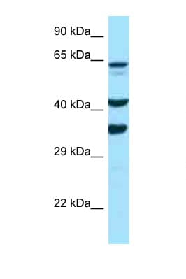 Osteonectin / SPARC Antibody (C-Terminus, HRP)