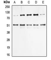 Polyclonal Rabbit anti-Human NFKB1 / NF-Kappa-B Antibody (phospho-Ser337, IHC, WB)