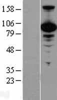 VCP Protein (Over-Expression Lysate Myc-DDK (Flag))