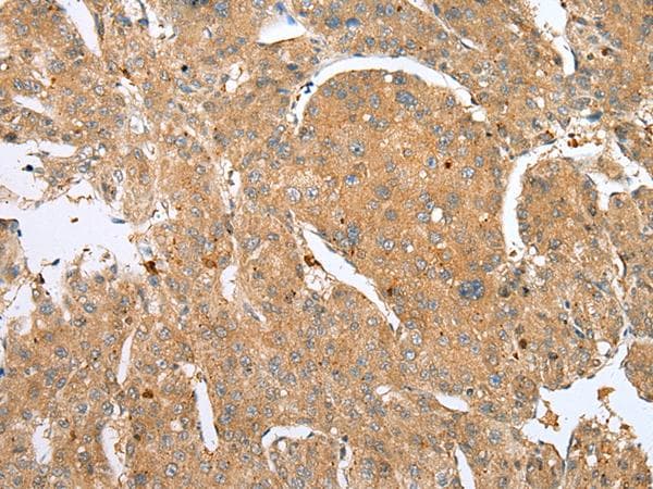 DCX / Doublecortin Antibody