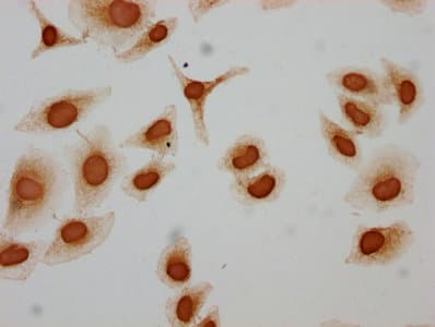 Polyclonal Rabbit anti-Human HIST1H3A Antibody (IHC, WB)