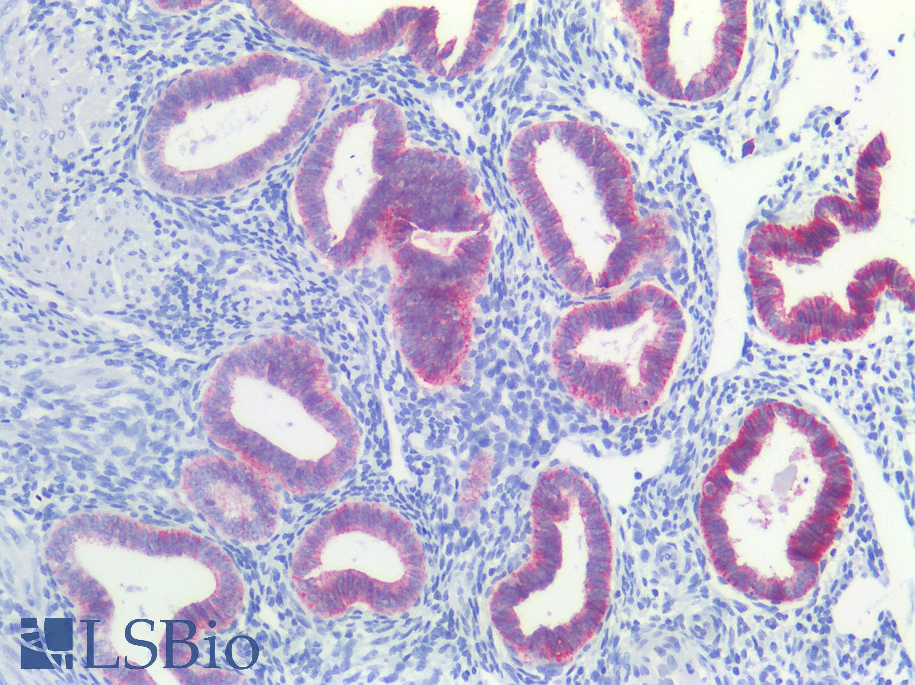 PathPlus™ Polyclonal Rabbit anti-Human CLDN3 / Claudin 3 Antibody (C-Terminus, IHC, IF, WB)