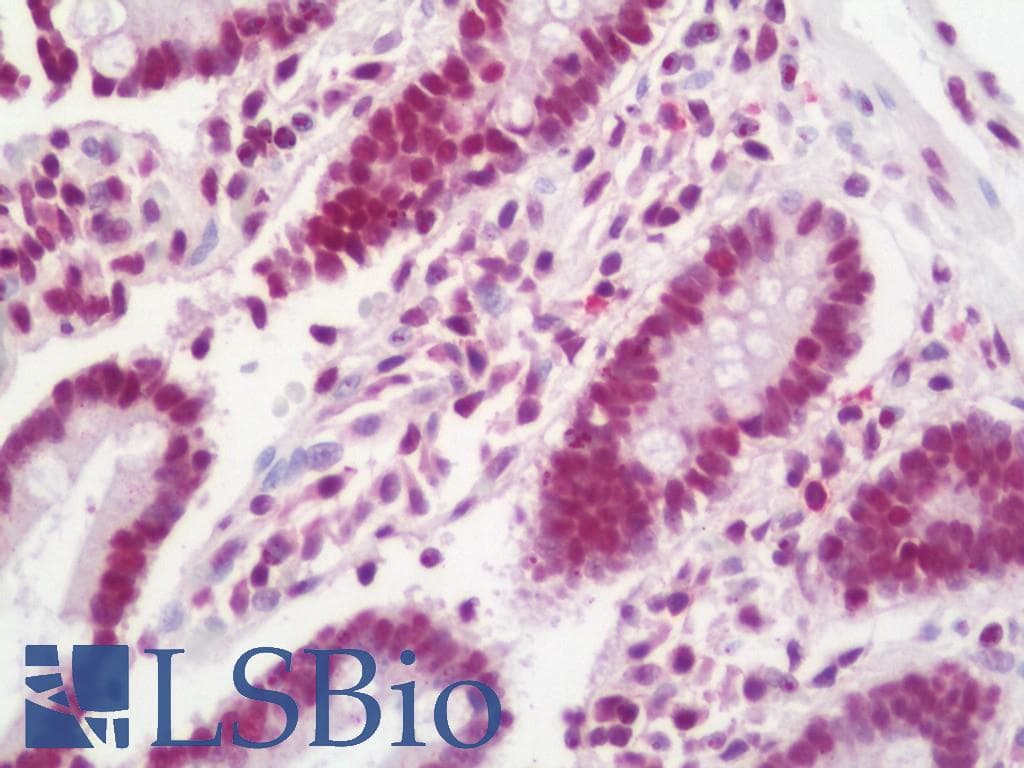 IHC-plus™ DHX8 Antibody (aa325-375)