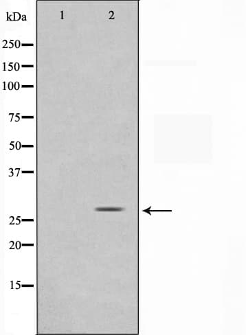 SENP8 Antibody
