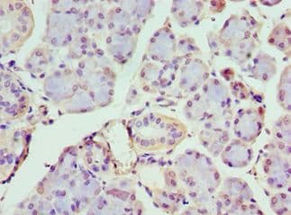 Polyclonal Rabbit anti-Human IFIH1 / MDA5 Antibody (aa1-205, IHC)