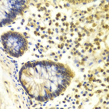 Polyclonal Rabbit anti-Human MSH2 Antibody (IHC, IF, WB)