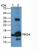 Hemoglobin Antibody