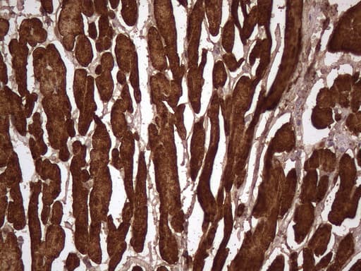 TNNT2 / CTNT Antibody (clone UMAB205, Carrier-free)