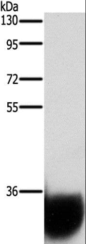 Polyclonal Rabbit anti-Human GPM6A / Glycoprotein M6A Antibody (IHC, WB)