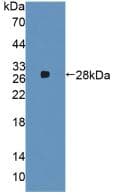 A2M / Alpha-2-Macroglobulin Antibody (aa616-856)