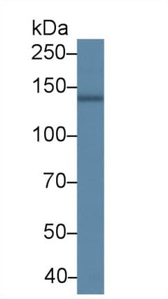 ATP2A2 / SERCA2 Antibody (aa315-756, APC)