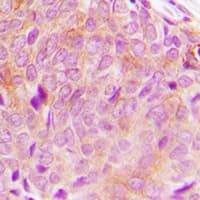 PLCG2 / PLC Gamma 2 Antibody (C-Terminus)