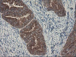SENP2 Antibody (aa139-523, clone OTI1B8)