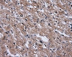 HDAC10 Antibody (clone OTI8G5)