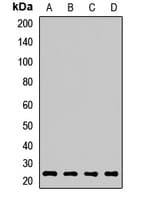 Polyclonal Rabbit anti-Human RAB2A / RAB2 Antibody (WB)