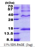Human INHBC Protein (Recombinant His)